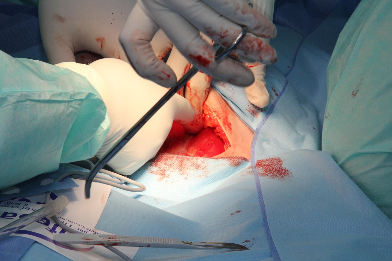 Dermasurgic klinika: ko tikėtis iš procedūrų ir kodėl čia veikia ne tik lazeriai, bet ir „chirurginiai dulkių siurbliai“ švarai užtikrinti